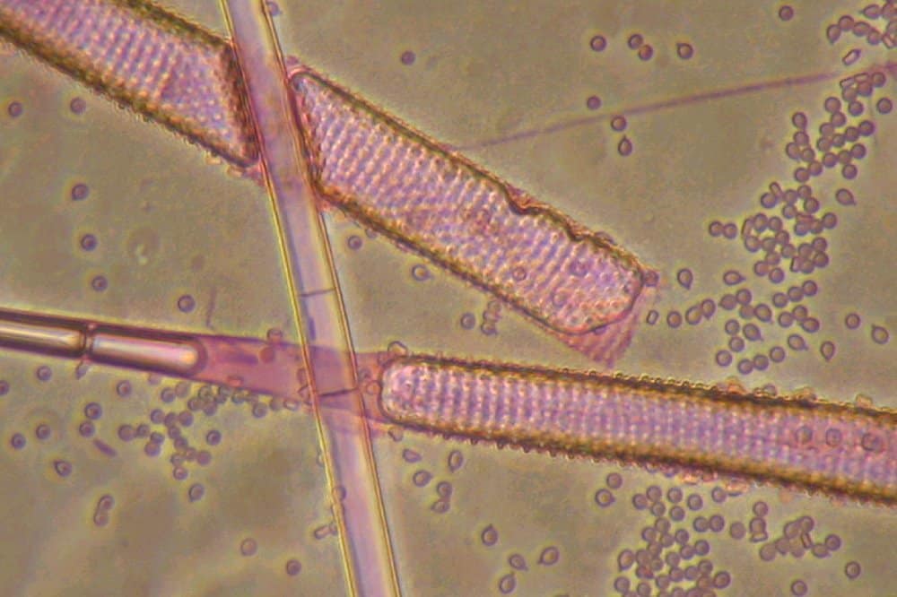 Mycotypha microspora
