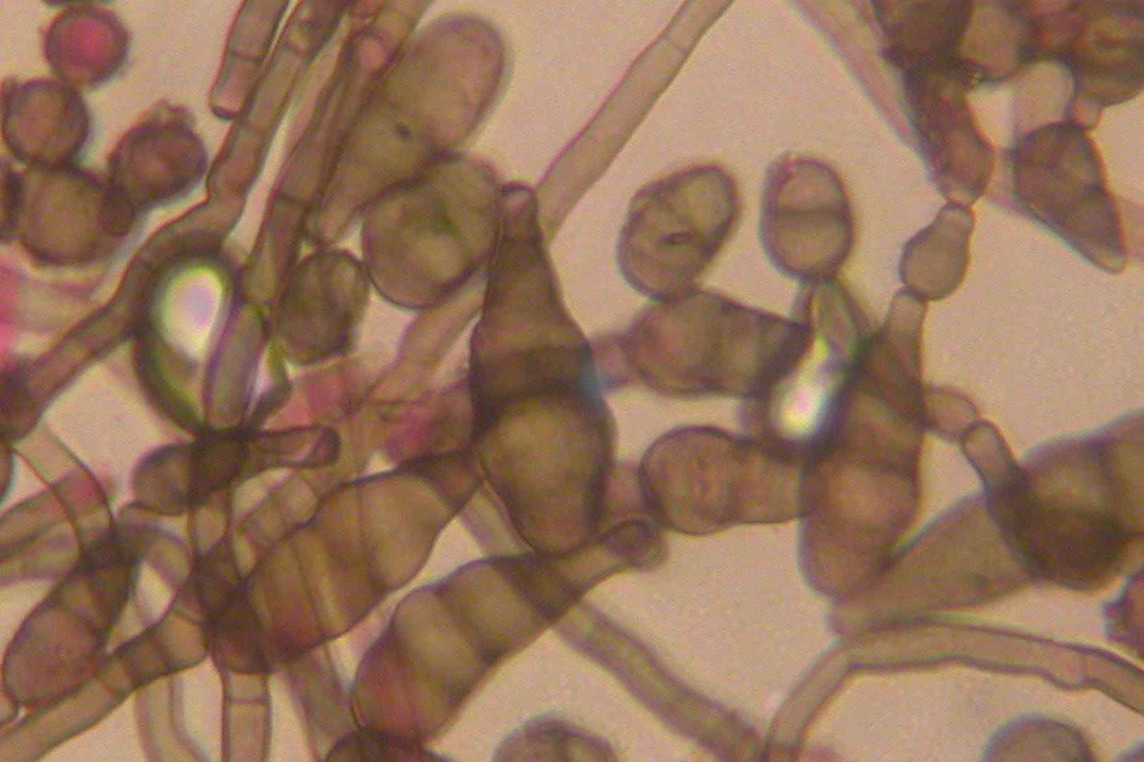 Alternaria micro