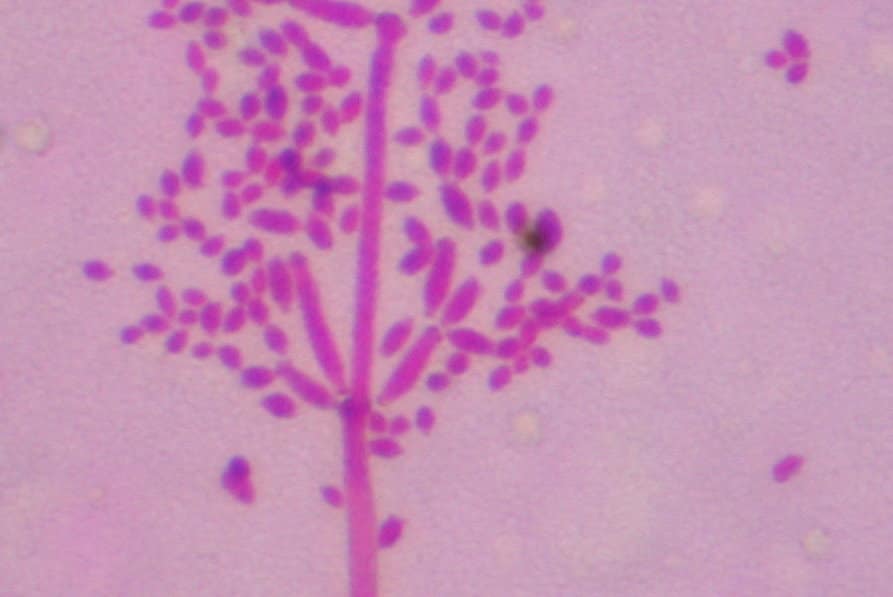Cladosporium cladosporiodes